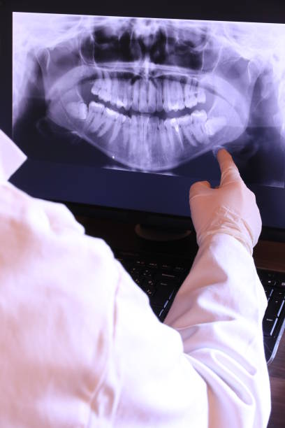 Best Emergency Treatment for Dental Infections or Abscesses in Haskell, TX