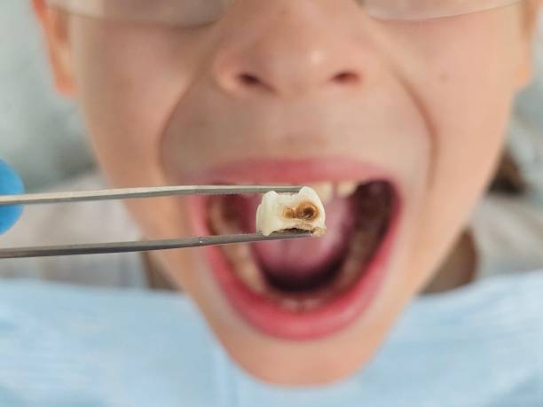 Best Weekend Emergency Dentist in Haskell, TX