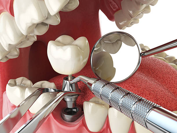 Best Same-Day Emergency Dental Services in Haskell, TX