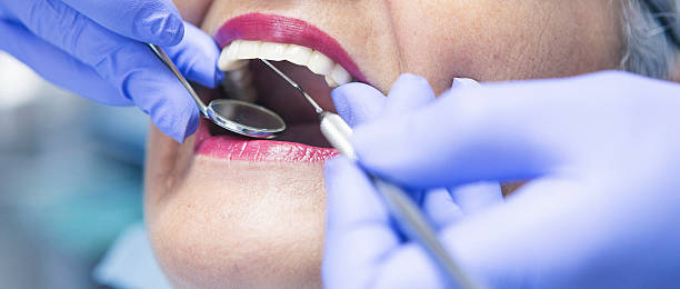 Best Emergency Dental Care for Broken or Chipped Teeth in Haskell, TX
